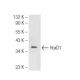 ECV304 Cell Lysate: sc-2269. Western blot analysis of HoxD1 expression... 
