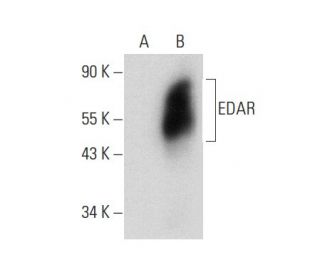 EDAR Antibody (F-5) - Western Blotting - Image 303770