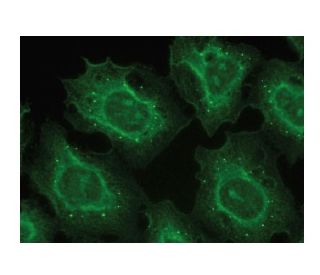 Edc4 Antibody (F-1) - Immunofluorescence - Image 149362 