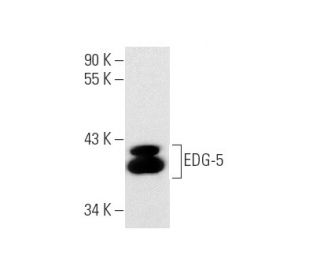 EDG-5 Antibody (E-12) - Western Blotting - Image 145585Each CRISPR/Cas9 Knockout (KO) Plasmid product consists of a pool of 3 plasmids designed to ensure identification and cleavage of a specific gene for maximum knockout efficiency. Each plasmid encodes a unique 20 nt sequence derived from the GeCKO (v2) library.