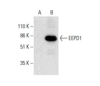EEPD1 Antibody (A-5) - Western Blotting - Image 301424 