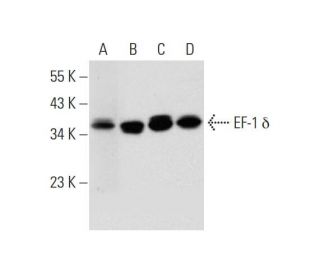 EF-1 &delta; Antibody (3J6) - Western Blotting - Image 297908