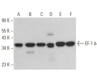 EF-1 &delta; Antibody (G-7) - Western Blotting - Image 367650 