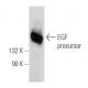 EGF Antibody (F-9) - Western Blotting - Image 109572