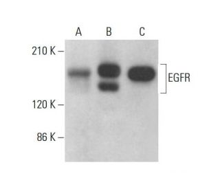 EGFR Antibody (0.N.268) - Western Blotting - Image 377579 