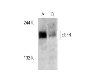 EGFR Antibody (3H2094) - Western Blotting - Image 139536 
