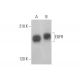 EGFR Antibody (3H2094) - Western Blotting - Image 353230 