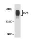 EGFR Antibody (3i4) - Western Blotting - Image 18128