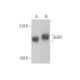 EGFR Antibody (3i4) - Western Blotting - Image 353229 