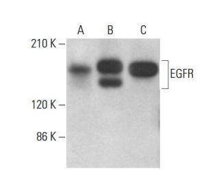 EGFR Antibody (3i4) - Western Blotting - Image 377578 