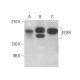 EGFR Antibody (3i4) - Western Blotting - Image 377578 