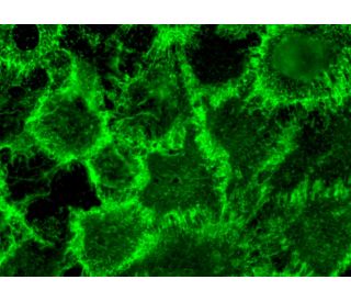 EGFR Antibody (EGFR.1) - Immunofluorescence - Image 370922
