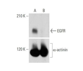 EGFR CRISPR/Cas9 KO Plasmid (h): sc-400015. Western blot analysis of human EGFR expression in empty vector control (A) and 
