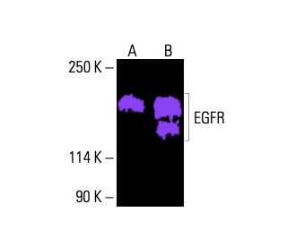 EGFR Antibody (A-10) - Western Blotting - Image 404862 