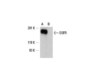 EGFR siRNA (h): sc-29301. Western blot analysis of EGFR expression in non-transfected control (A) and EGFR siRNA transfect 