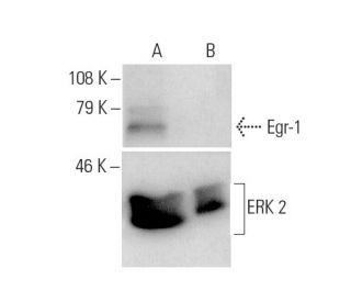 Egr-1 siRNA (h): sc-29303. Western blot analysis of Egr-1 expression in non-transfected control (A) and Egr-1 siRNA transf 