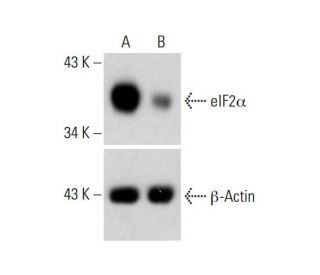 eIF2&alpha; CRISPR/CAS9 KO Plasmid (h): sc-400199. Western blot analysis of eIF2&alpha; expression in empty vector control (A) and eIF 