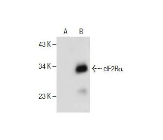 eIF2Bα Antibody (C-11) - Western Blotting - Image 159785SAM Transcription Activation: SAM system utilizing dCas9-VP64, MS2-P65-HSF1, and sgRNA for precise gene transcription activation.