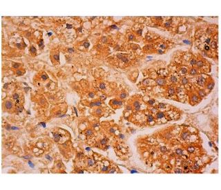 eIF2B&beta; Antibody (E-12) - Immunohistochemistry - Image 313930 