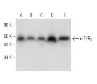 eIF2B&gamma; Antibody (D-8) - Western Blotting - Image 316268 