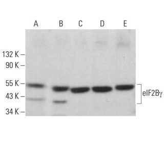 eIF2B&gamma; Antibody (P-5) - Western Blotting - Image 380214 