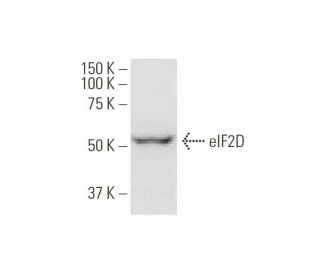 eIF2D Antibody (2D10) - Western Blotting - Image 347550 