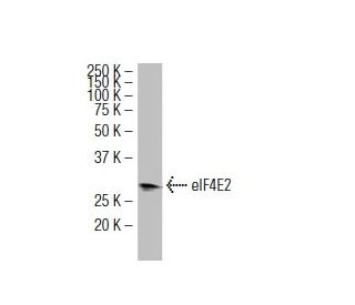 eIF4E2 Antibody (YB-18) - Western Blotting - Image 34104Each CRISPR/Cas9 Knockout (KO) Plasmid product consists of a pool of 3 plasmids designed to ensure identification and cleavage of a specific gene for maximum knockout efficiency. Each plasmid encodes a unique 20 nt sequence derived from the GeCKO (v2) library.