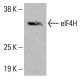 CANT1 抗体 (B-12):sc -515315。通过蛋白质印迹分析 HeLa (A) 和 HCT-116 (B) 完整细胞裂解物中的 CANT1 表达。使用的检测试剂:m-IgG Fc BP-HRP:sc-525409。 eIF4H Antibody (C-6) - Western Blotting - Image 415980