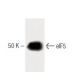 eIF5 Antibody (20) - Western Blotting - Image 60290 