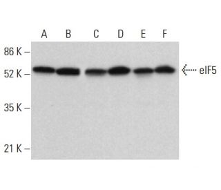 eIF5 Antibody (E-10) - Western Blotting - Image 380405 