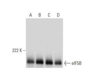 eIF5B Antibody (D-9) - Western Blotting - Image 296995 