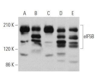 eIF5B Antibody (D-9) - Western Blotting - Image 366123 