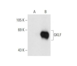 GKLF/KLF4 Antibody (B-9) - Western Blotting - Image 66366 