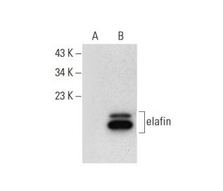 elafin Antibody (H-2) - Western Blotting - Image 300577SAM Transcription Activation: SAM system utilizing dCas9-VP64, MS2-P65-HSF1, and sgRNA for precise gene transcription activation.