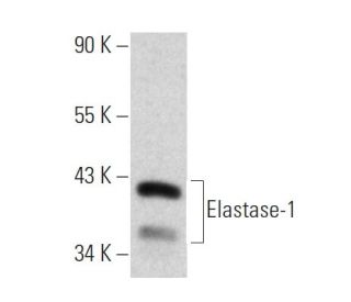 Elastase-1 Antibody (4H5) - Western Blotting - Image 374542
