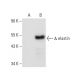 elastin Antibody (B-10) - Western Blotting - Image 72735