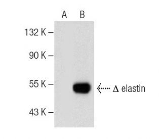 elastin (A-8): sc-374638. Western blot analysis of elastin expression in... 