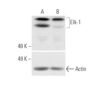 Elk-1 siRNA (h): sc-35290. Western blot analysis of Elk-1 expression in non-transfected control (A) and Elk-1 siRNA transf 