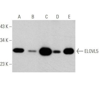 ELOVL5 Antibody (B-3) - Western Blotting - Image 349072 