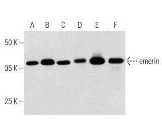 emerin Antibody (A-5) - Western Blotting - Image 356973 