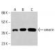抗体 RasGRP4 (E-2):sc-515508。Western blot分析未处理(A)和化学处理(B)的K-562完整细胞裂解物中RasGRP4的表达。β-肌动蛋白(C4):sc-47778用作加载对照。使用的检测试剂: m-IgG Fc BP-HRP:sc-525409。 emerin Antibody (A-5) - Western Blotting - Image 416030