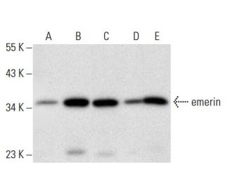 emerin Antibody (F-11) - Western Blotting - Image 303511 
