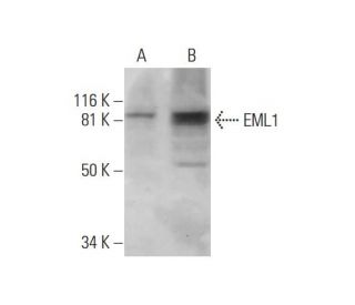 EML1 Antibody (B-3) - Western Blotting - Image 290815 