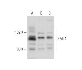 EML4 Antibody (H.21) - Western Blotting - Image 333869 