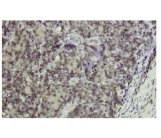 EMP-3 Antibody (SW-5) - Immunohistochemistry - Image 35891 