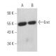 Emt Antibody (0.T.74) - Western Blotting - Image 363945 