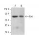 Emt Antibody (0.T.74) - Western Blotting - Image 383097