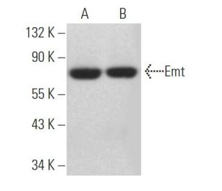 Emt Antibody (3F227) - Western Blotting - Image 363946 