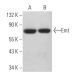 Emt Antibody (3F227) - Western Blotting - Image 363946 