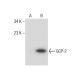 ENA-78 Antibody (D-6) - Western Blotting - Image 260772
